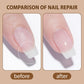 💎Żel do paznokci Rapid Repair Broken Nail Gel